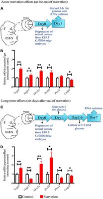 Neuronal Dysfunction Is Linked to the Famine-Associated Risk of Proliferative Retinopathy in Patients With Type 2 Diabetes